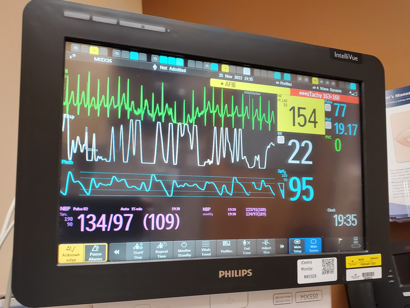 AFIB in the emergency room.